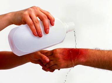 آموزش شستشوی زخم + نکات ضروری