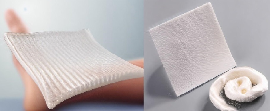 تفاوت آلژینات و هیدروفایبر